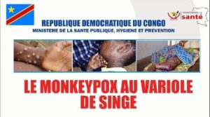 RDC : L'organisation mondiale de la santé alerte sur la propagation de l'épidémie de Monkey Pox L'organisation mondiale de la santé alerte sur la propagation de l'épidémie de Monkey Pox
