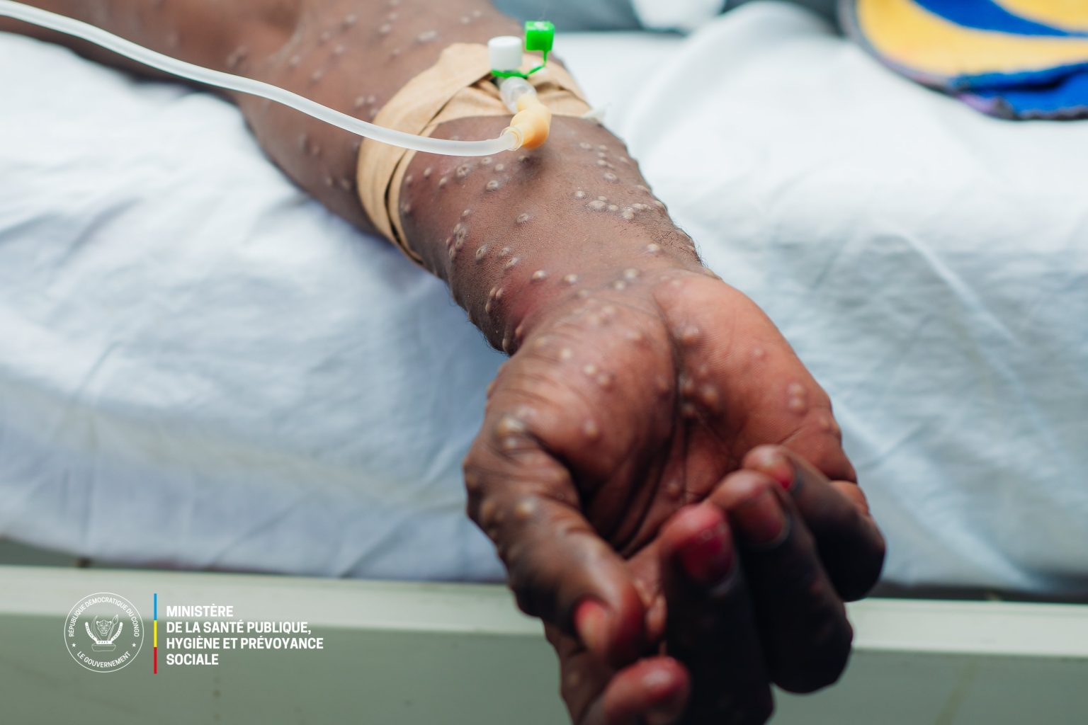 L'UNICEF apporte son secours avec 80 tonnes de médicaments aux provinces du Nord-Kivu, Sud-Kivu et Ituri