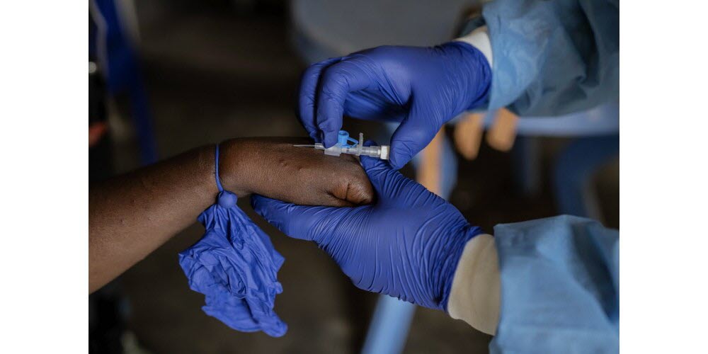 Plus de 39.000 personnes vaccinées contre le Mpox