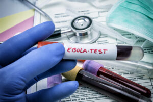 un premier patient guéri d’Ebola en Ituri