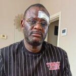 Claude Pero Luwara de nouveau agressé à Tirlemont