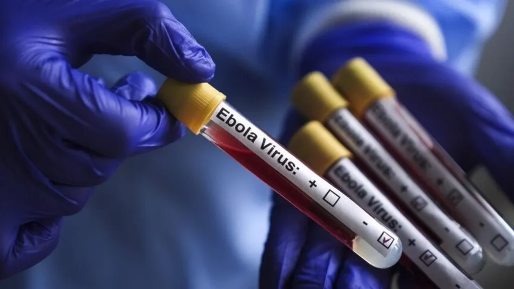 RDC : 8.116 cas d’Ebola recensés dans sept provinces 8.116 cas d’Ebola recensés dans sept provinces
