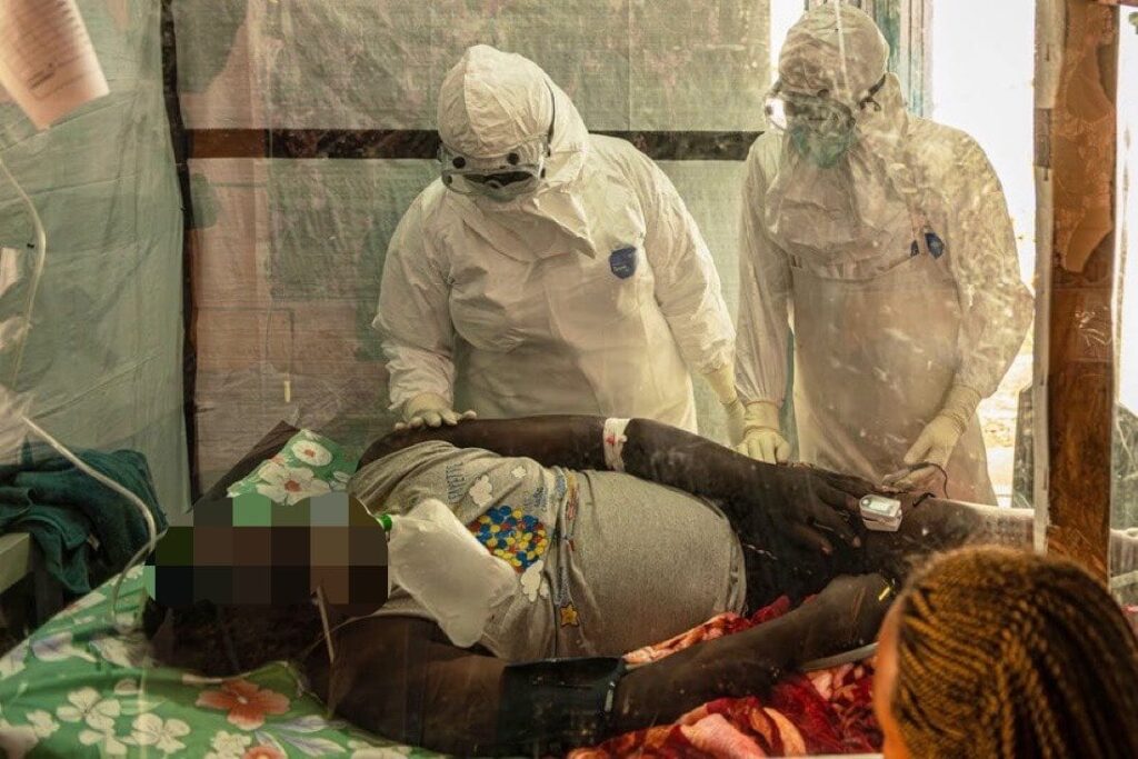 un nouveau cas d’Ebola confirmé dans une zone sous contrôle de l’AFC/M23
